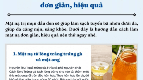 Cách làm mặt nạ trị mụn đầu đen tại nhà đơn giản, hiệu quả