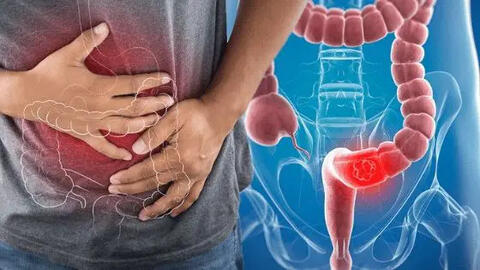 Hai vợ chồng phát hiện mắc chung 1 bệnh ung thư trong vòng 1 năm, thừa nhận có thói quen sai lầm mà nhiều gia đình người Việt đang mắc phải