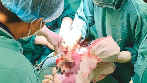 Hi hữu: 1 buổi sáng, 2 em bé chào đời cùng vòng tránh thai của mẹ