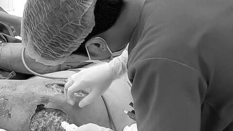 Nguy kịch chỉ từ vài nốt mụn nhọt