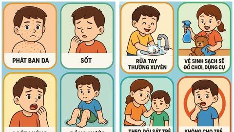 TP Hồ Chí Minh: EV71 gây bệnh tay chân miệng nặng quay trở lại