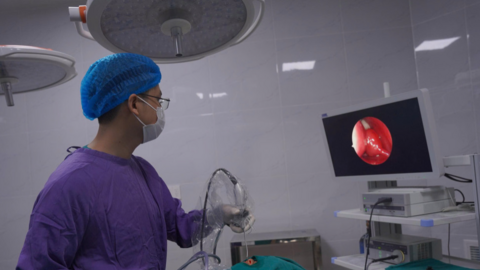 Chiếc răng mọc lạc trong hốc mũi của bệnh nhi 8 tuổi