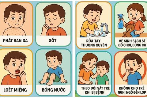 TP Hồ Chí Minh: EV71 gây bệnh tay chân miệng nặng quay trở lại