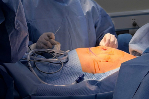 Phẫu thuật thành công cho cô gái mắc dị tật Poland hiếm gặp