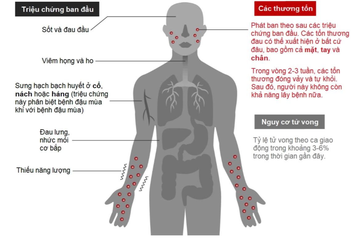 Bệnh đậu mùa khỉ có nguy hiểm không mà khiến WHO phải tuyên bố nó là tình trạng khẩn cấp toàn cầu? - Ảnh 4.