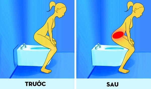 Phụ nữ đi vệ sinh kiểu này dễ bị nhiễm trùng tiết niệu - Ảnh 1. Phụ nữ đi vệ sinh kiểu này dễ bị nhiễm trùng tiết niệu - Ảnh 1.