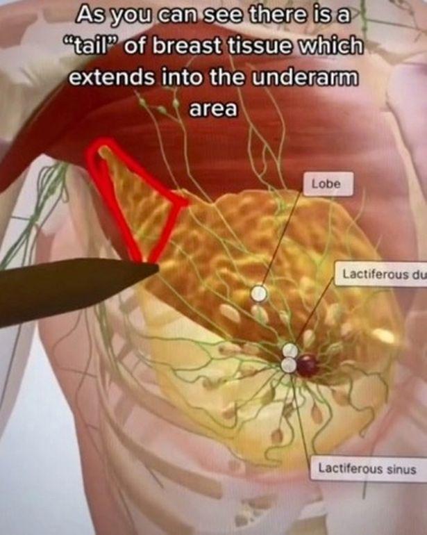 Bác sĩ cảnh báo về "điểm mù" trong kiểm tra ung thư vú tại nhà thường bị bỏ qua - Ảnh 1.