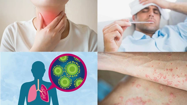 6 bệnh ung thư người Việt mắc phải nhiều nhất hiện nay - Ảnh 6.
