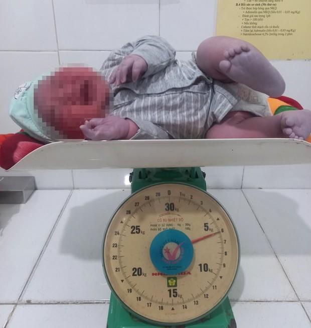 Hà Tĩnh: Thêm một trẻ chào đời cân nặng 6kg - Ảnh 2.