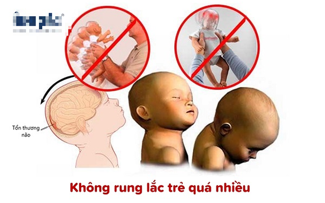 Rung lắc trẻ sơ sinh nguy hiểm thế nào? Những bệnh tiềm ẩn trẻ có thể mắc phải? - Ảnh 3.