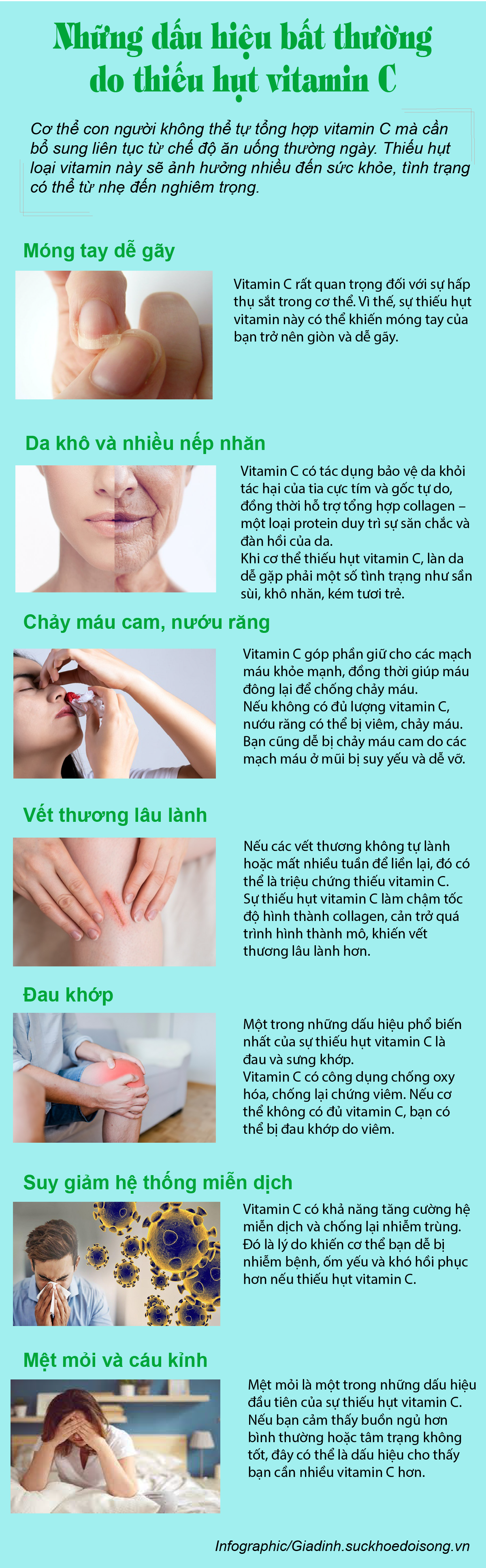 Gặp phải những dấu hiệu bất thường này nhiều khả năng cơ thể bạn đang thiếu hụt vitamin C - Ảnh 1.