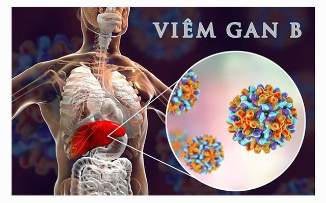 Người đàn ông 42 người bị ung thư gan do mắc sai lầm này, ai có dấu hiệu bệnh này cần được khám càng sớm càng tốt - Ảnh 3.