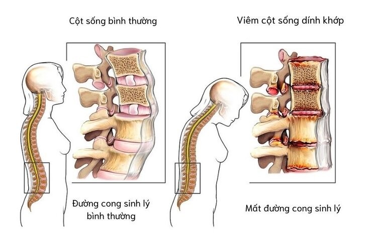 Minh họa/INT