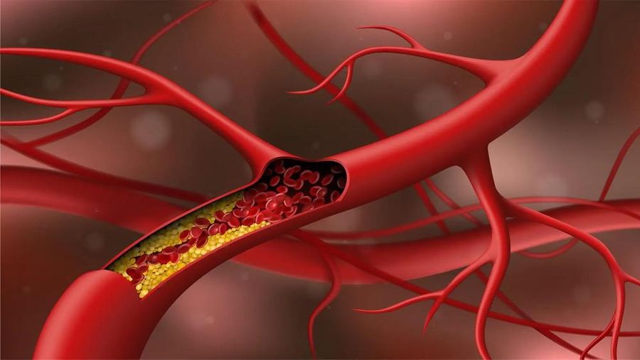 Một đánh giá năm 2019 cho thấy, ăn các loại đậu giúp giảm mức cholesterol.