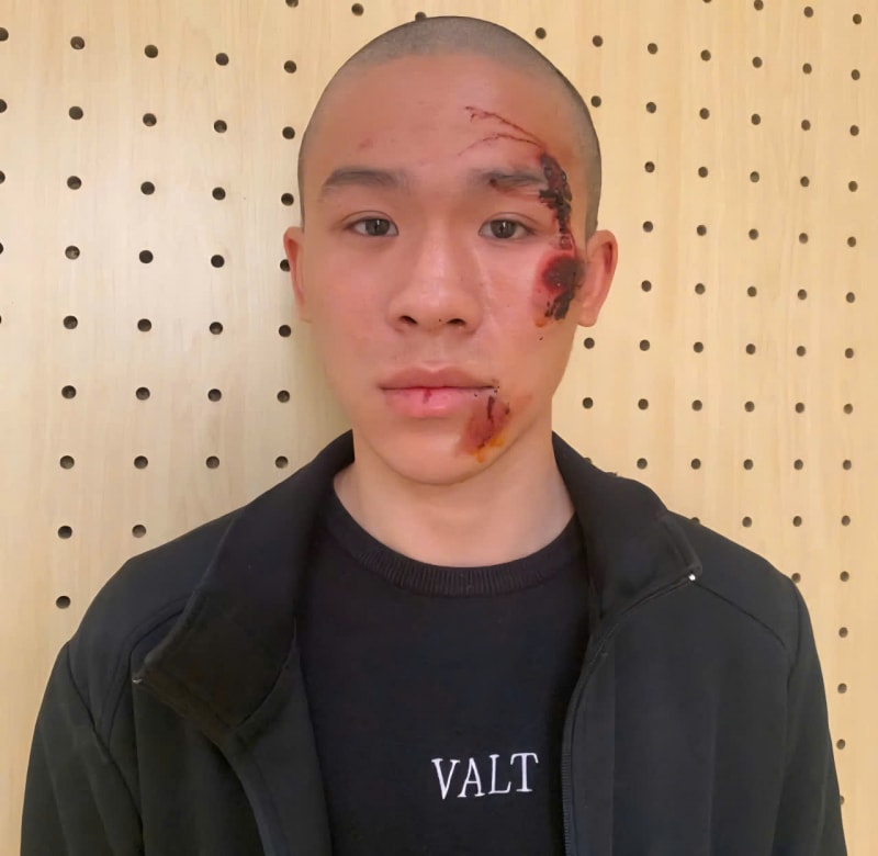 Tạm giữ hình sự đối tượng lao xe vào Cảnh sát giao thông -0