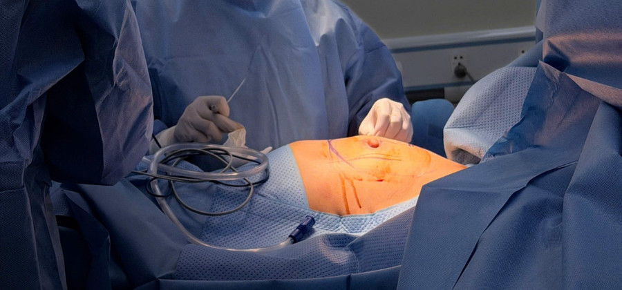 Bệnh nhân được phẫu thuật hai lần.